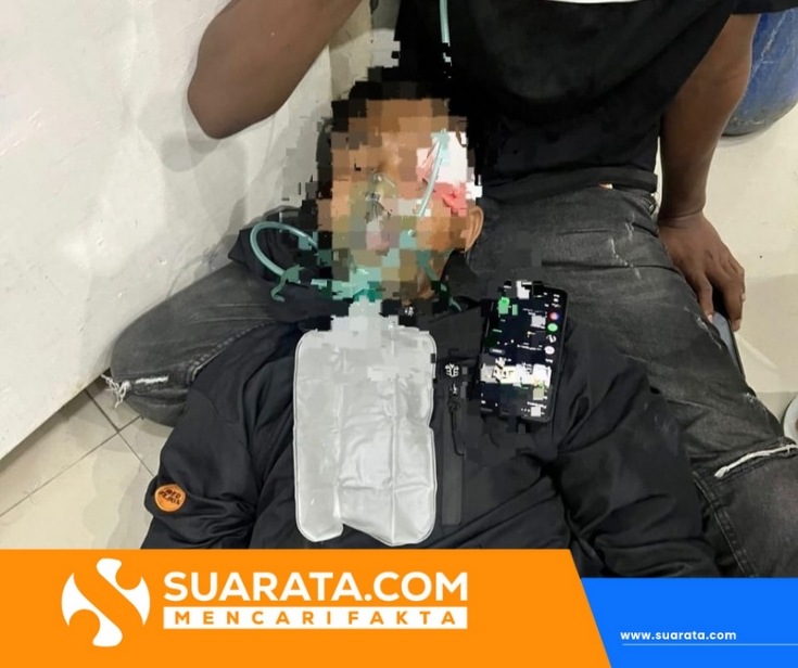 Remaja di Polman Jadi Korban Pelemparan Batu oleh OTK, Luka di Pelipis