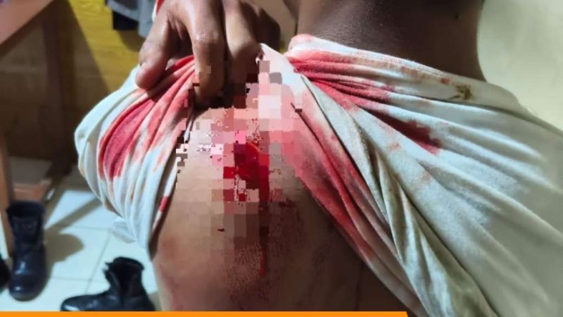 OTK Serang Tiga Remaja di Polman, Polisi Buru Delapan Pelaku