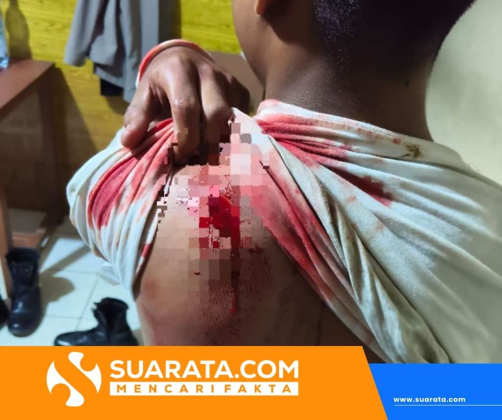 OTK Serang Tiga Remaja di Polman, Polisi Buru Delapan Pelaku