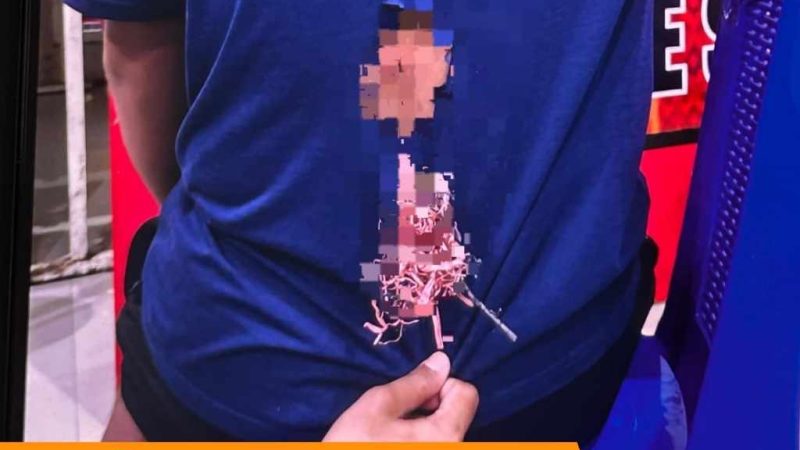 Kasus Pembusuran Wonomulyo: Imran Luka Kena Panah Saat Berkendara Malam