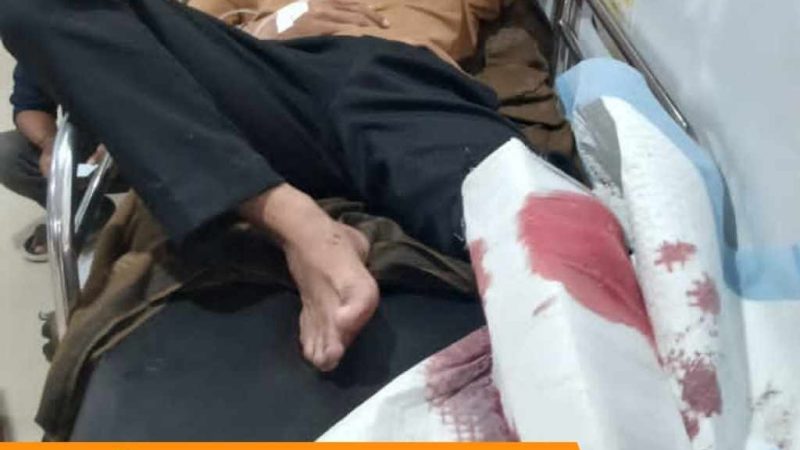 Tabrakan Motor di Wonomulyo, Korban Luka dan Kendaraan Rusak