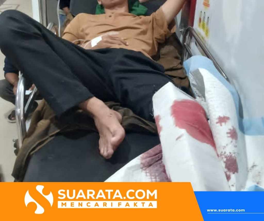 Tabrakan Motor di Wonomulyo, Korban Luka dan Kendaraan Rusak